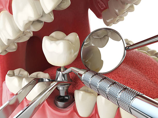 Best Broken or Cracked Tooth Emergency Dentist in White City, UT